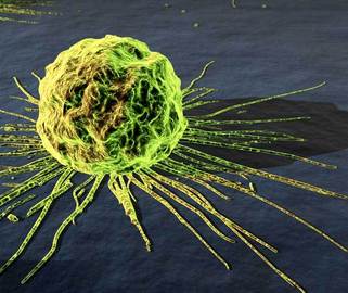 What Makes the Body Succumb To Cancer