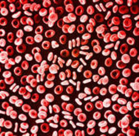 a Disease That Is Characterised By a Low Red Blood Cell Count