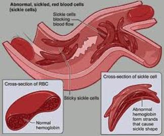 Types Of Diseases Of Cardiovascular System