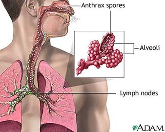 How To Treat Throat Cancer