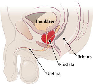 About Symptoms And Treatments For Prostate Cancer