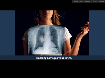 5 Common Signs Of Diseases Caused By Smoking	