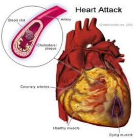 What are the different causes of heart diseases