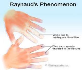 Why is raynaud's diseases dangerous for childrens