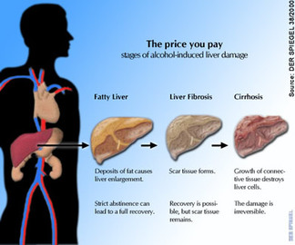 What Are The Causes Of Alcoholic Diseases	