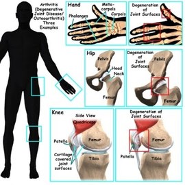 What Are The Causes Of Rheumatology Diseases	