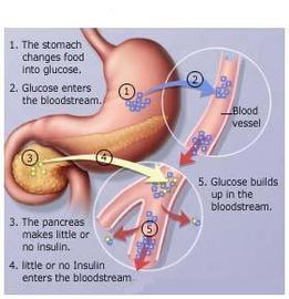 Symptoms Of Diabetes Related Diseases	