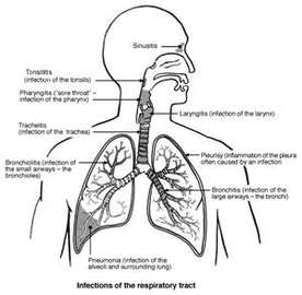 Diseases In Respiratory System