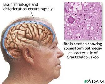 what are the dieseases affecting the nervous system