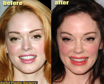 Types Of New Plastic Surgery Now Offered
