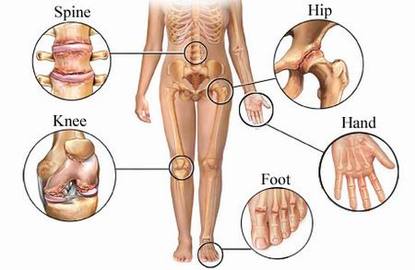 Information About Joint Diseases