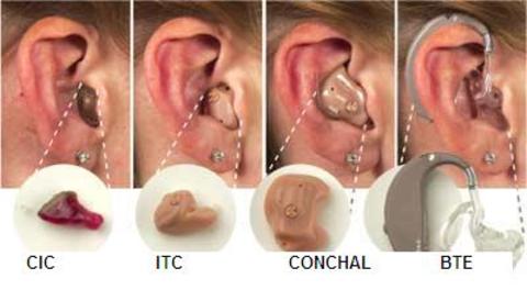 Cost Of Digital Hearing Aids