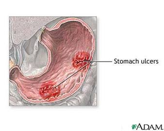  Treatment Of Diseases Caused From Alcoholism