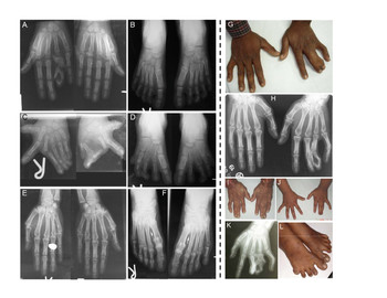 The Meaning Of the Word Phenotypic