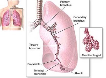 what is psittacosis?