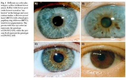  How To Treat  Diabetic Eye Diseases	