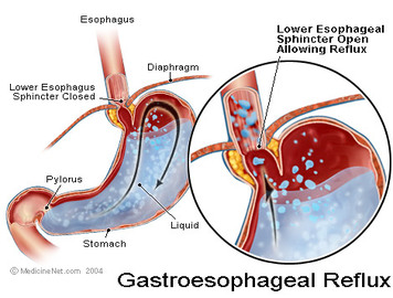 How To Treat Digestive Tract Diseases	