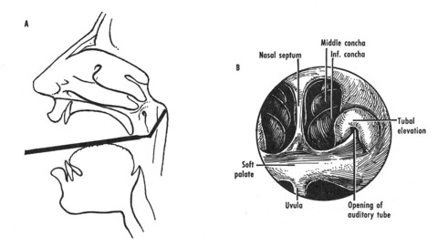 How Is a Rhinoscopy Completed