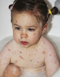 What Are The Causes Of Pediatric Diseases	