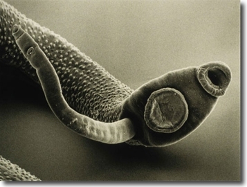 What Diseases Can Parasites Cause?