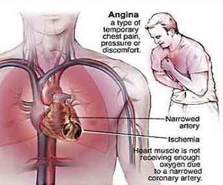 Classification Of Diseases in Human Beings