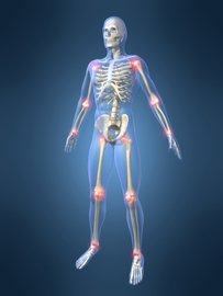 Most Common Hospital For Joint Diseases