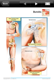 Most Common Hospital For Joint Diseases