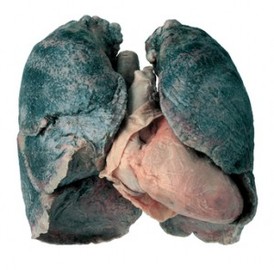 Risk Factors For Occupational Lung Diseases