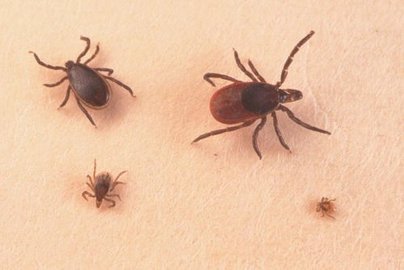 What you need to know about lyme diseases