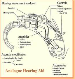 Benefits Of Digital Hearing Aids