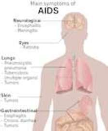 History Of the Aids Drugs