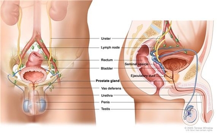 What Cancer Are Men Prone To