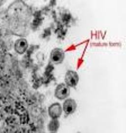 Best Ways To Treat Diseases Hiv Aids