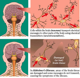 what are the most common diseases that you can inherit