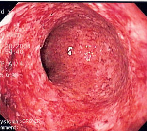 How To Diagnose Intestinal Diseases