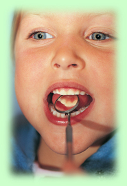 Oral Diseases That Are Preventable