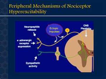 Diseases That Can Lead To Hyperexcitability