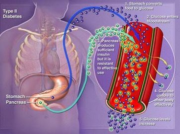 Symptoms Of Diabetes Related Diseases	